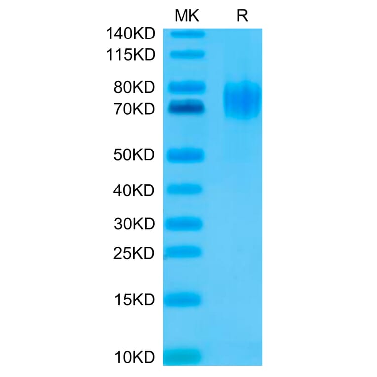 Tris-Bis PAGE - Recombinant Human EGFR Protein (C-terminal His and Avi Tag) (A331622) - Antibodies.com