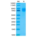 Tris-Bis PAGE - Recombinant Human EGFR Protein (C-terminal His and Avi Tag) (A331622) - Antibodies.com