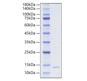 SDS-PAGE - Recombinant Human/Mouse/Rat HMGB1 Protein (A331623) - Antibodies.com