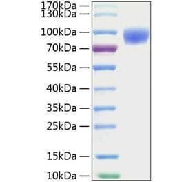 SDS-PAGE - Recombinant Mouse ICAM1 Protein (C-terminal His Tag) (A331624) - Antibodies.com