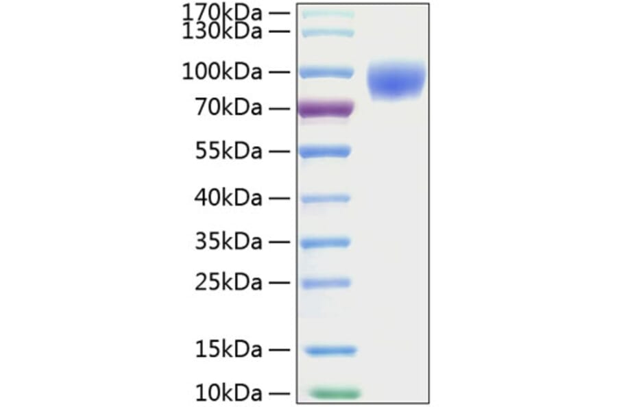 SDS-PAGE - Recombinant Mouse ICAM1 Protein (C-terminal His Tag) (A331624) - Antibodies.com
