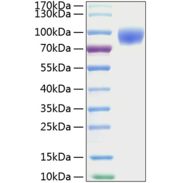 SDS-PAGE - Recombinant Mouse ICAM1 Protein (C-terminal His Tag) (A331624) - Antibodies.com