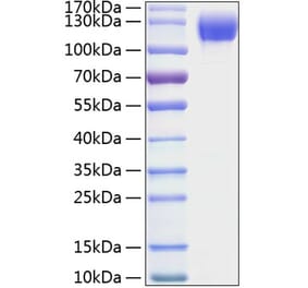 SDS-PAGE - Recombinant Mouse ICAM1 Protein (C-terminal Human Fc and His Tag) (A331625) - Antibodies.com