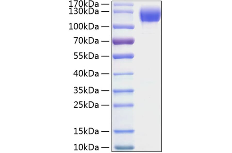 SDS-PAGE - Recombinant Mouse ICAM1 Protein (C-terminal Human Fc and His Tag) (A331625) - Antibodies.com