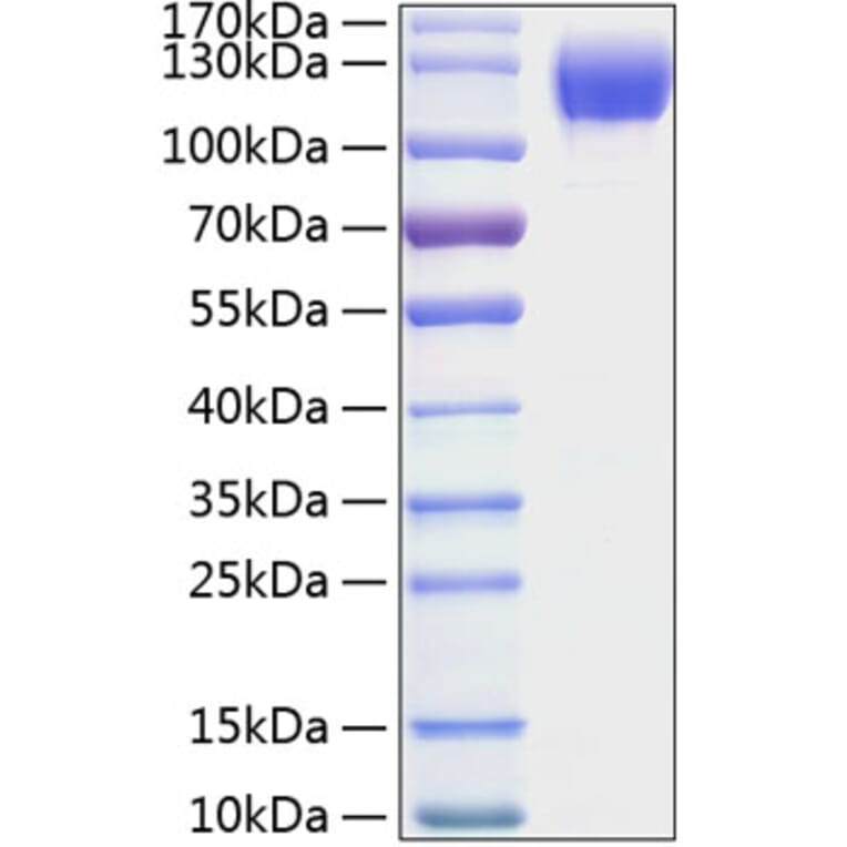 SDS-PAGE - Recombinant Mouse ICAM1 Protein (C-terminal Human Fc and His Tag) (A331625) - Antibodies.com