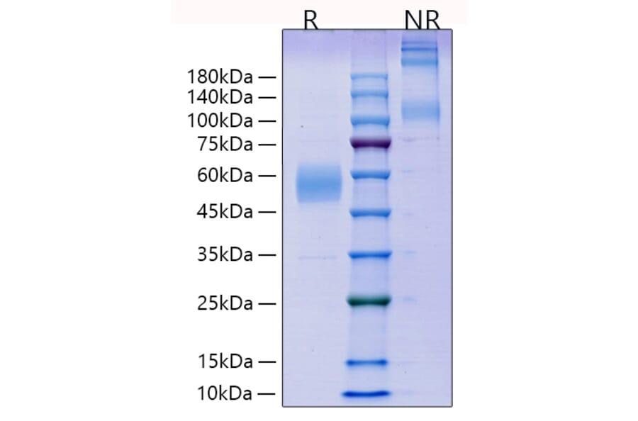 SDS-PAGE - Recombinant Mouse ICOS Protein (C-terminal Human Fc Tag) (A331626) - Antibodies.com