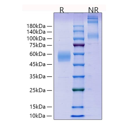 SDS-PAGE - Recombinant Mouse ICOS Protein (C-terminal Human Fc Tag) (A331626) - Antibodies.com
