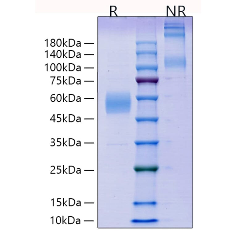SDS-PAGE - Recombinant Mouse ICOS Protein (C-terminal Human Fc Tag) (A331626) - Antibodies.com
