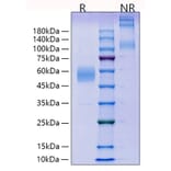 SDS-PAGE - Recombinant Mouse ICOS Protein (C-terminal Human Fc Tag) (A331626) - Antibodies.com