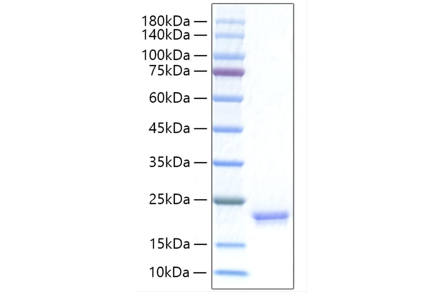 SDS-PAGE - Recombinant Human IFNA17 Protein (C-terminal His Tag) (A331633) - Antibodies.com