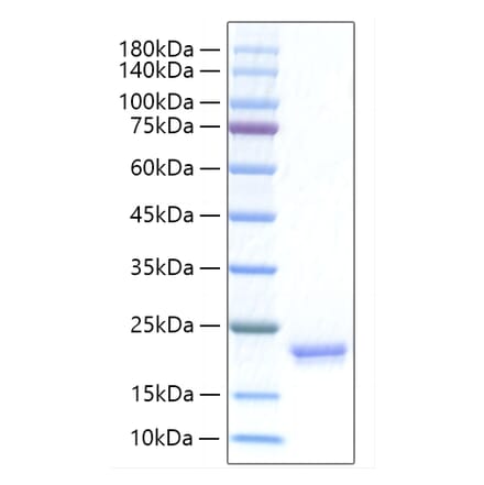 SDS-PAGE - Recombinant Human IFNA17 Protein (C-terminal His Tag) (A331633) - Antibodies.com