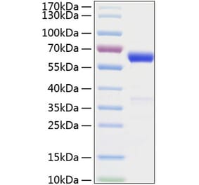 SDS-PAGE - Recombinant Mouse IFN beta Protein (C-terminal Human Fc and His Tag) (A331635) - Antibodies.com