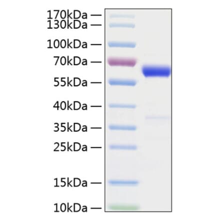 SDS-PAGE - Recombinant Mouse IFN beta Protein (C-terminal Human Fc and His Tag) (A331635) - Antibodies.com