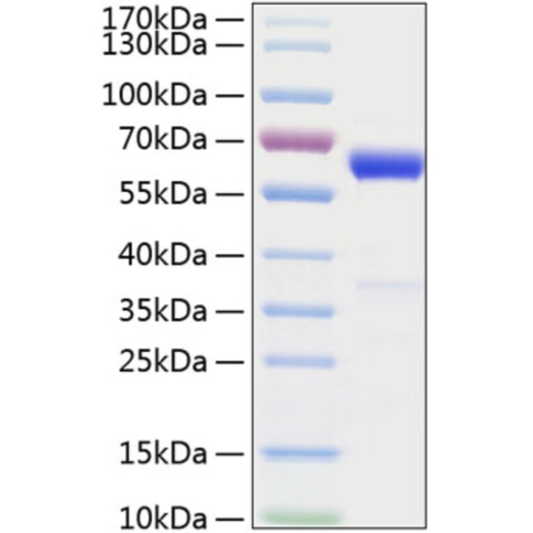 SDS-PAGE - Recombinant Mouse IFN beta Protein (C-terminal Human Fc and His Tag) (A331635) - Antibodies.com