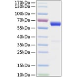 SDS-PAGE - Recombinant Mouse IFN beta Protein (C-terminal Human Fc and His Tag) (A331635) - Antibodies.com