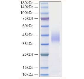 SDS-PAGE - Recombinant Mouse IFN beta Protein (A331636) - Antibodies.com