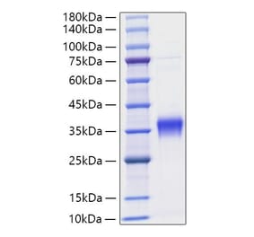 SDS-PAGE - Recombinant Mouse IFN beta Protein (C-terminal His Tag) (A331637) - Antibodies.com