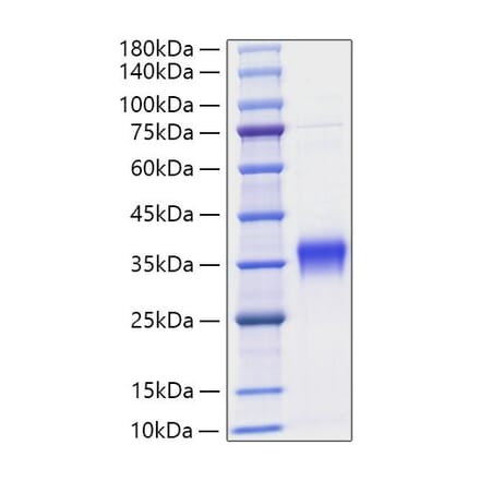SDS-PAGE - Recombinant Mouse IFN beta Protein (C-terminal His Tag) (A331637) - Antibodies.com