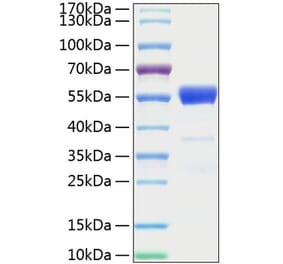SDS-PAGE - Recombinant Mouse IFN gamma Protein (C-terminal Human Fc and His Tag) (A331638) - Antibodies.com