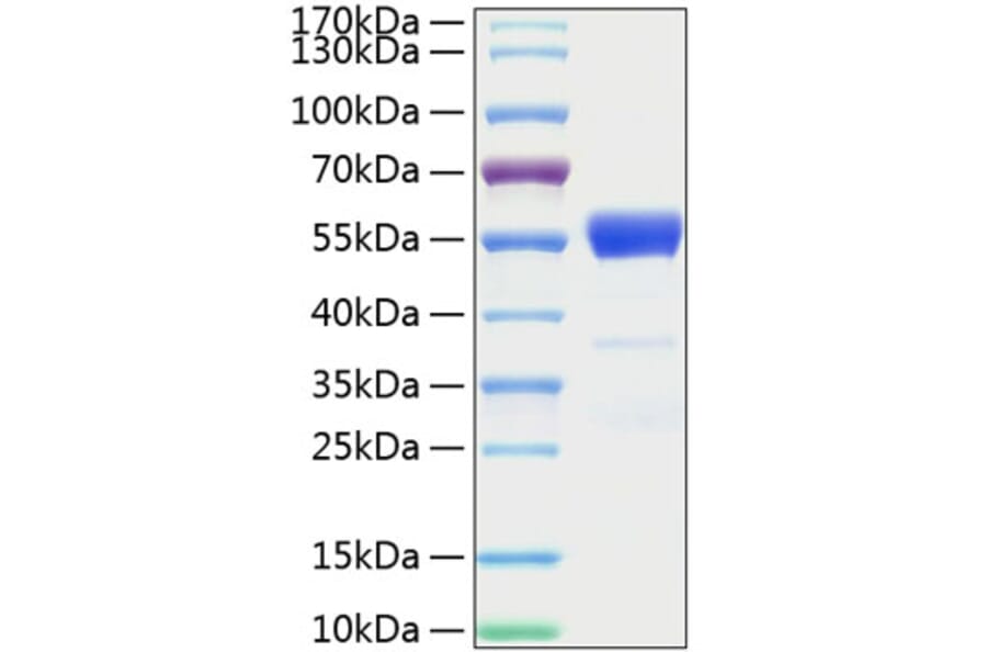 SDS-PAGE - Recombinant Mouse IFN gamma Protein (C-terminal Human Fc and His Tag) (A331638) - Antibodies.com