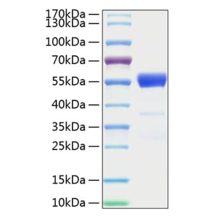 SDS-PAGE - Recombinant Mouse IFN gamma Protein (C-terminal Human Fc and His Tag) (A331638) - Antibodies.com