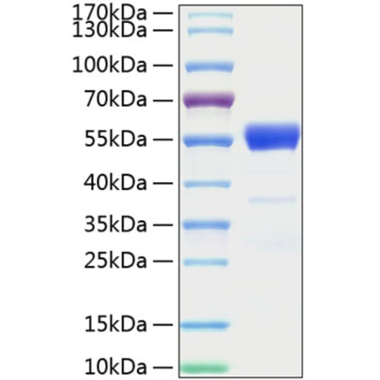 SDS-PAGE - Recombinant Mouse IFN gamma Protein (C-terminal Human Fc and His Tag) (A331638) - Antibodies.com