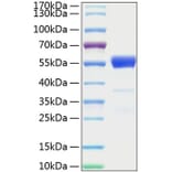 SDS-PAGE - Recombinant Mouse IFN gamma Protein (C-terminal Human Fc and His Tag) (A331638) - Antibodies.com