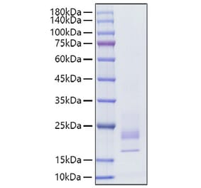SDS-PAGE - Recombinant Rat IFN gamma Protein (C-terminal His Tag) (A331639) - Antibodies.com