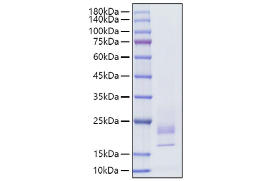 SDS-PAGE - Recombinant Rat IFN gamma Protein (C-terminal His Tag) (A331639) - Antibodies.com