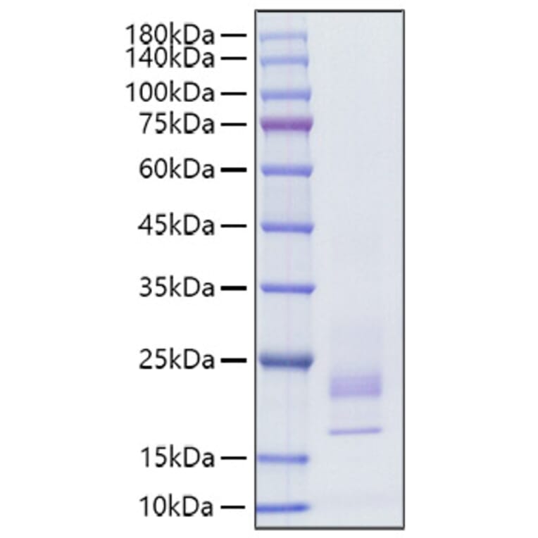 SDS-PAGE - Recombinant Rat IFN gamma Protein (C-terminal His Tag) (A331639) - Antibodies.com