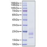 SDS-PAGE - Recombinant Rat IFN gamma Protein (C-terminal His Tag) (A331639) - Antibodies.com
