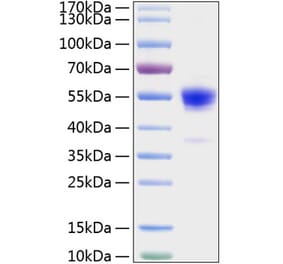 SDS-PAGE - Recombinant Rat IFN gamma Protein (C-terminal Human Fc and His Tag) (A331640) - Antibodies.com
