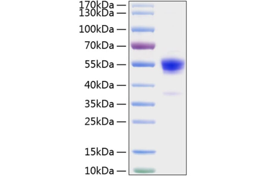 SDS-PAGE - Recombinant Rat IFN gamma Protein (C-terminal Human Fc and His Tag) (A331640) - Antibodies.com
