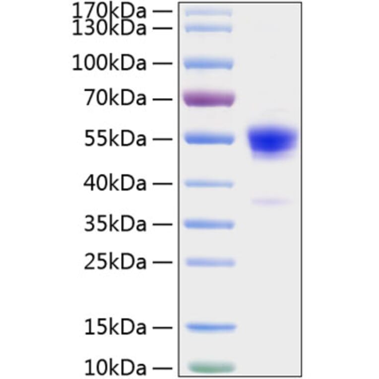 SDS-PAGE - Recombinant Rat IFN gamma Protein (C-terminal Human Fc and His Tag) (A331640) - Antibodies.com