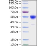 SDS-PAGE - Recombinant Rat IFN gamma Protein (C-terminal Human Fc and His Tag) (A331640) - Antibodies.com