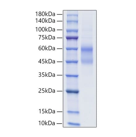 SDS-PAGE - Recombinant Human IgD Protein (C-terminal His Tag) (A331642) - Antibodies.com