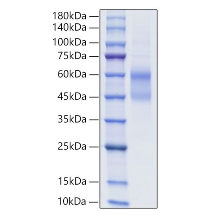 SDS-PAGE - Recombinant Human IgD Protein (C-terminal His Tag) (A331642) - Antibodies.com