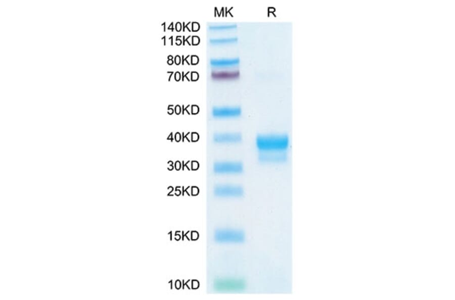 Tris-Bis PAGE - Recombinant Cynomolgus macaque IgE Protein (C-terminal His and Avi Tag) (A331643) - Antibodies.com