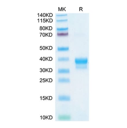 Tris-Bis PAGE - Recombinant Cynomolgus macaque IgE Protein (C-terminal His and Avi Tag) (A331643) - Antibodies.com