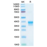 Tris-Bis PAGE - Recombinant Cynomolgus macaque IgE Protein (C-terminal His and Avi Tag) (A331643) - Antibodies.com