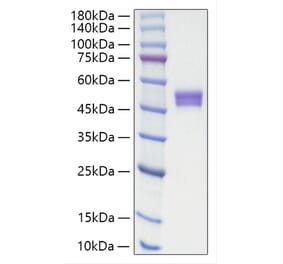 SDS-PAGE - Recombinant Human IgE Protein (C-terminal His Tag) (A331644) - Antibodies.com