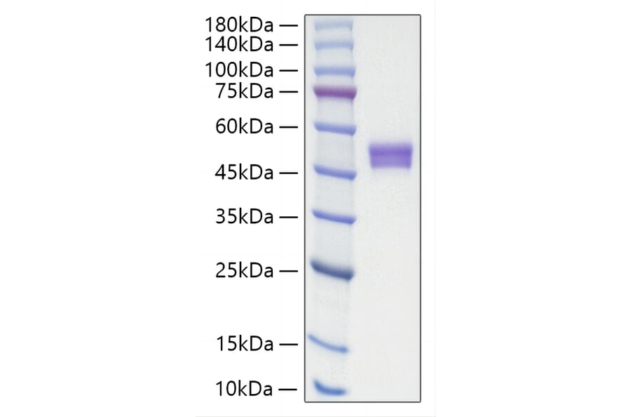 SDS-PAGE - Recombinant Human IgE Protein (C-terminal His Tag) (A331644) - Antibodies.com