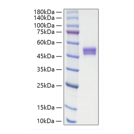 SDS-PAGE - Recombinant Human IgE Protein (C-terminal His Tag) (A331644) - Antibodies.com