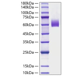 SDS-PAGE - Recombinant Mouse IgE Protein (C-terminal His Tag) (A331645) - Antibodies.com