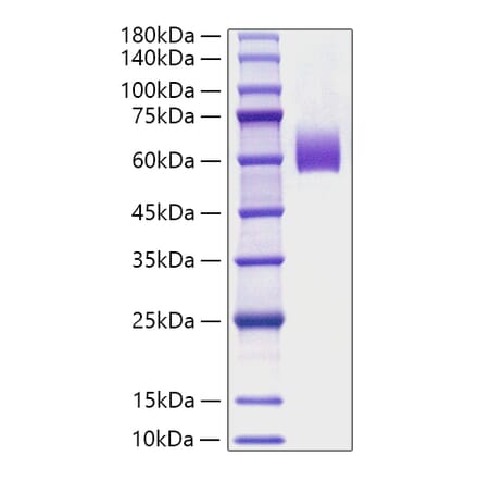 SDS-PAGE - Recombinant Mouse IgE Protein (C-terminal His Tag) (A331645) - Antibodies.com