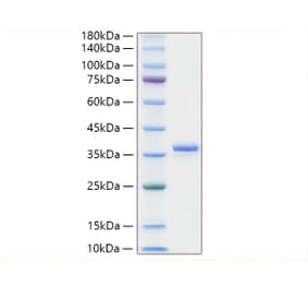 SDS-PAGE - Recombinant Mouse IGFBP2 Protein (C-terminal His Tag) (A331646) - Antibodies.com