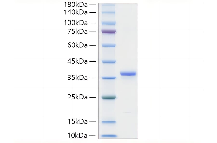 SDS-PAGE - Recombinant Mouse IGFBP2 Protein (C-terminal His Tag) (A331646) - Antibodies.com