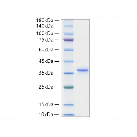 SDS-PAGE - Recombinant Mouse IGFBP2 Protein (C-terminal His Tag) (A331646) - Antibodies.com