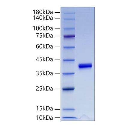 SDS-PAGE - Recombinant Mouse IGF1 Protein (N-terminal Human Fc Tag) (A331647) - Antibodies.com