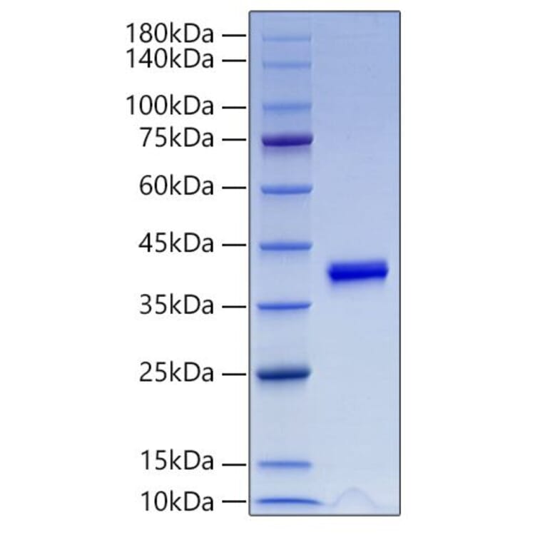SDS-PAGE - Recombinant Mouse IGF1 Protein (N-terminal Human Fc Tag) (A331647) - Antibodies.com
